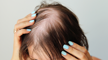 Strategies for Women to Prevent Frequent Hair Loss